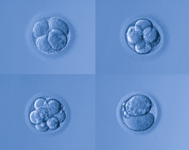 What is Preimplantation Genetic Screening in Surrogacy?