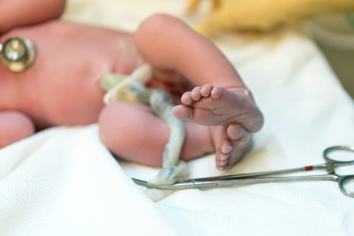 Benefits for Baby: Delayed Cord Clamping and Skin-to-Skin Contact