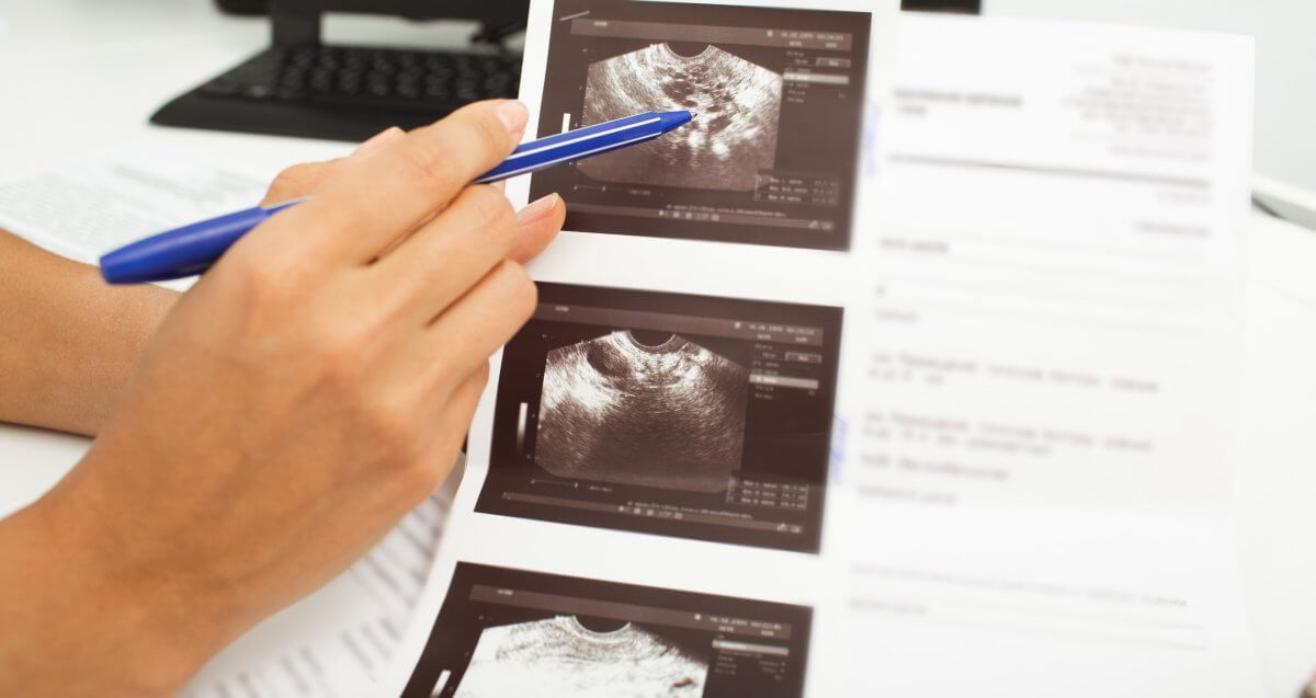 Do You Need a Saline Sonogram Before IVF? Here’s What It Reveals