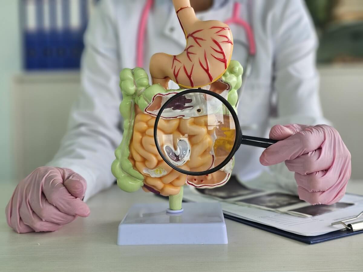 Crohn’s Disease and IVF Failure: Is There a Connection?